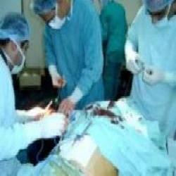لأول مرة.. طاقم طبي فلسطيني يجري عملية قلب مفتوح بمجمع الشفاء
